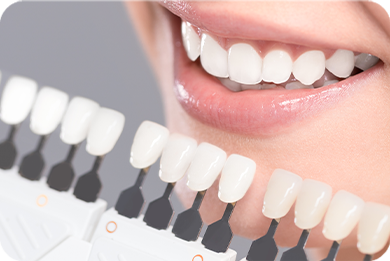 ホワイトニング